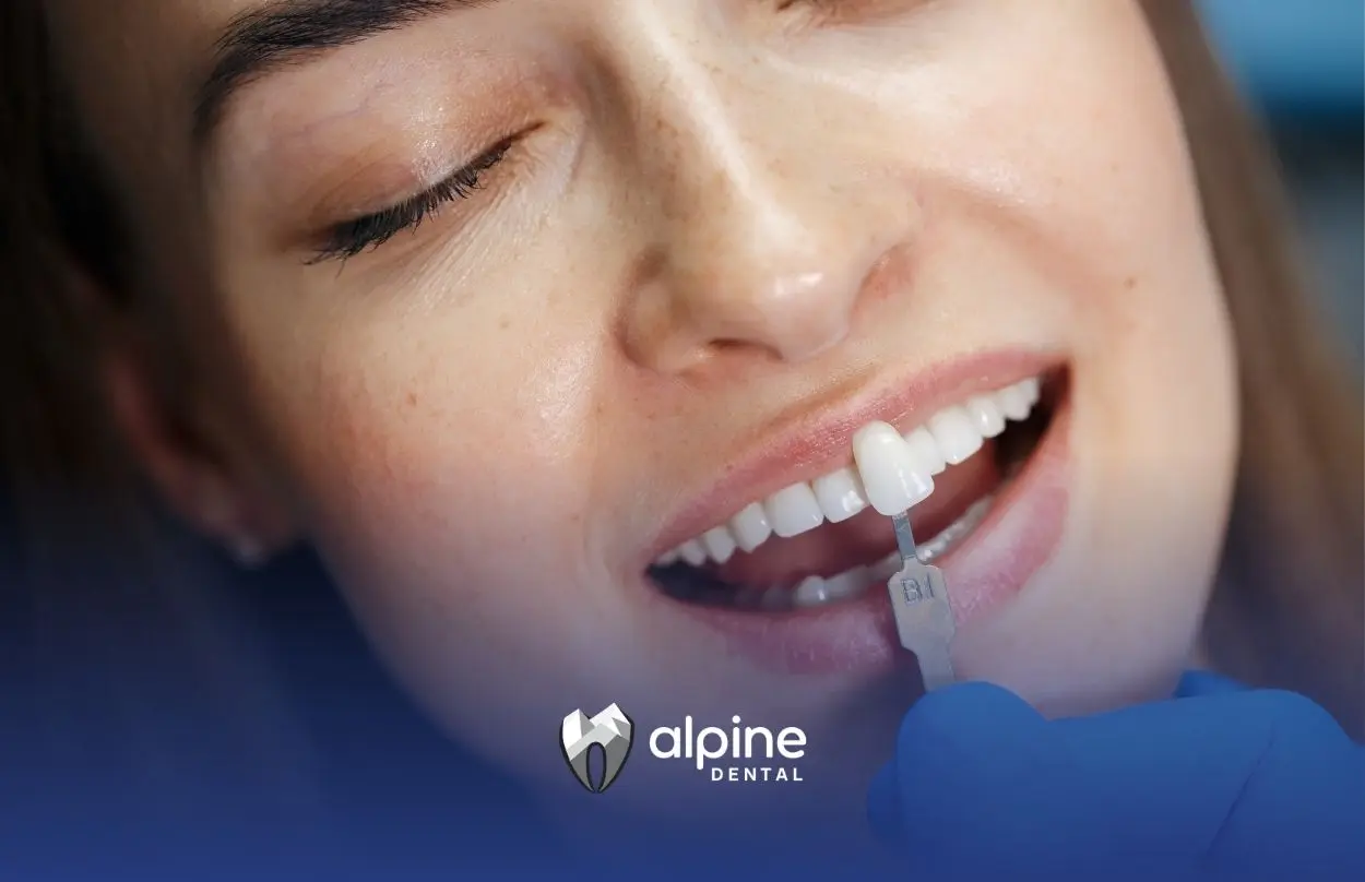 Dentist matching a porcelain shade tab to a patient's teeth to select the ideal crown color and natural-looking appearance.