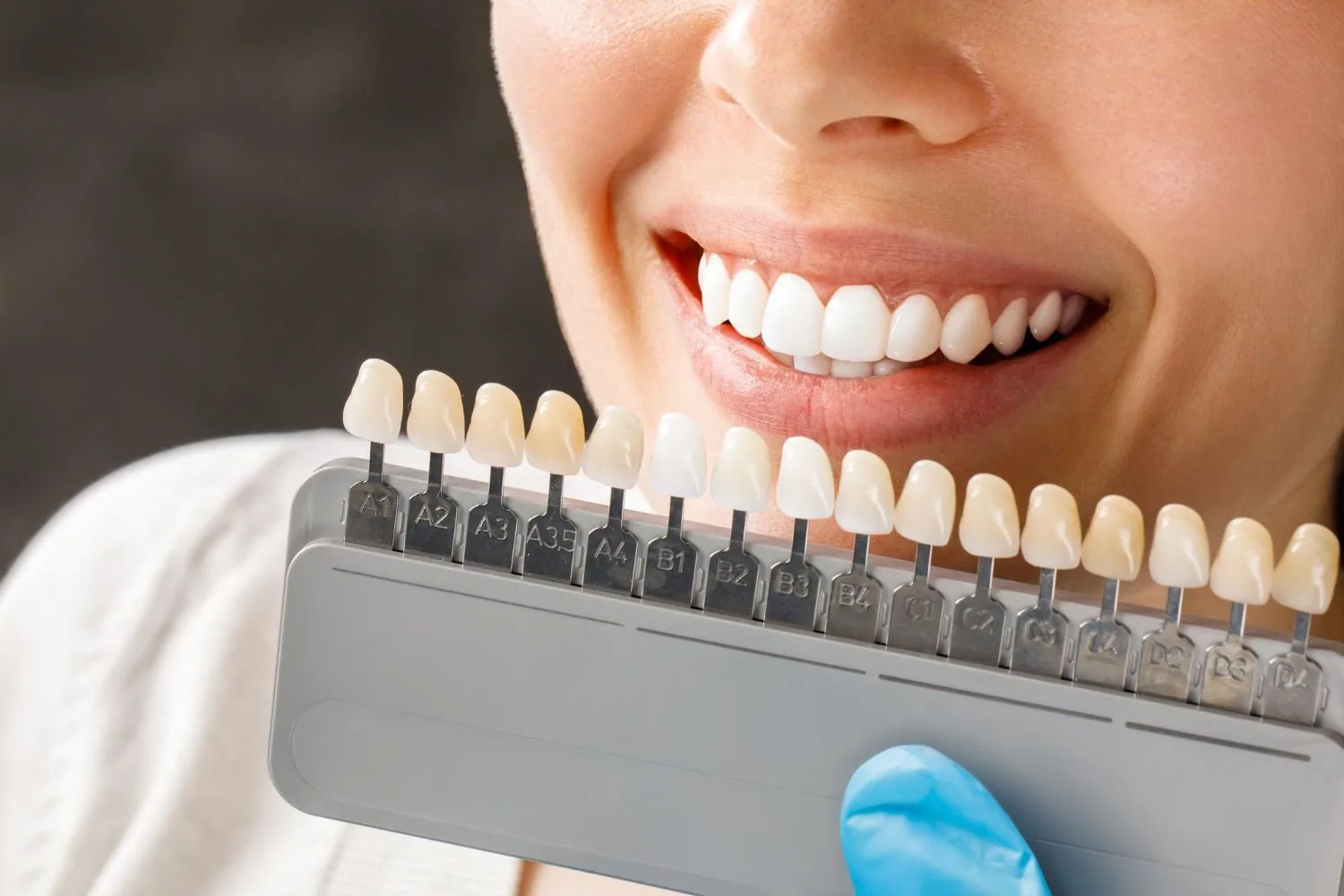 Dental Crowns